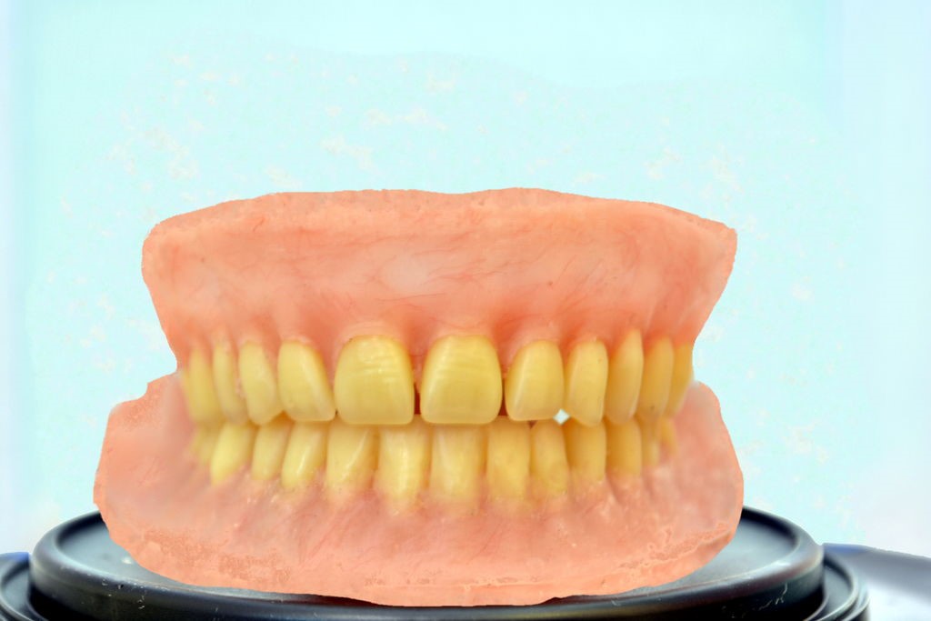 Acrylic Dentures Shields ND 58569